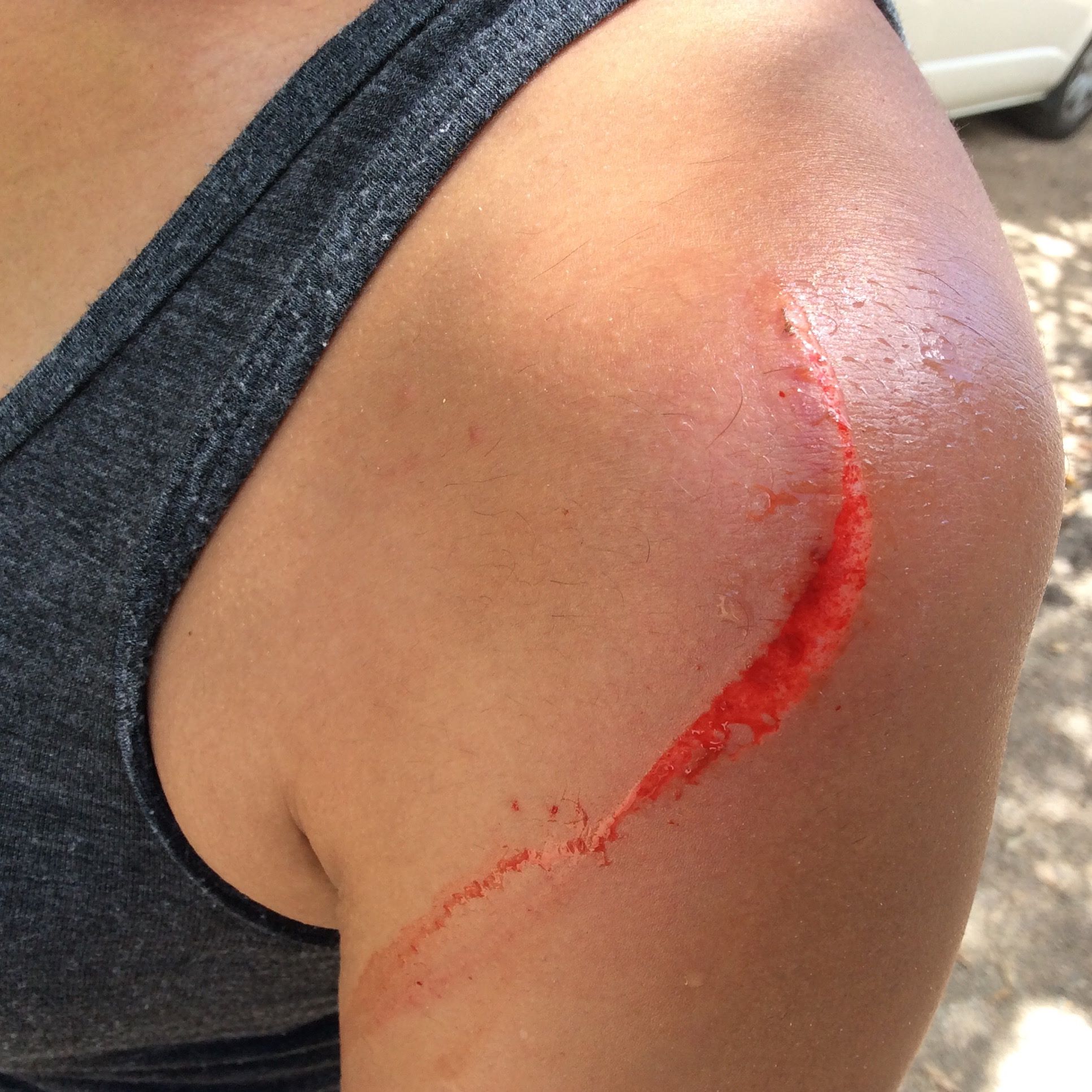 Una visitante muestra la herida provocada por un canguro. Foto: Kroosn Shuttle Service Pty LTD. / Facebook
