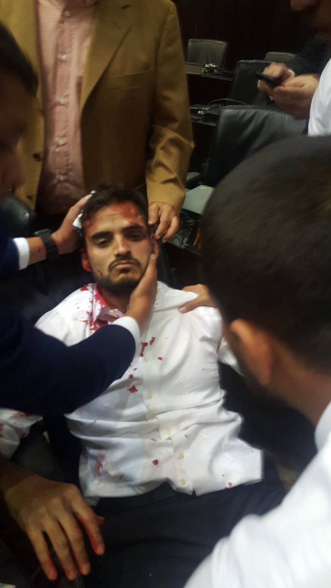Imagen de Armando Armas, uno de los diputados heridos durante el asalto