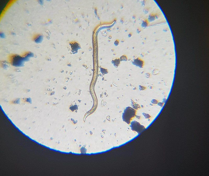 Nemátodo bajo el microscopio. Foto: Dominik1232