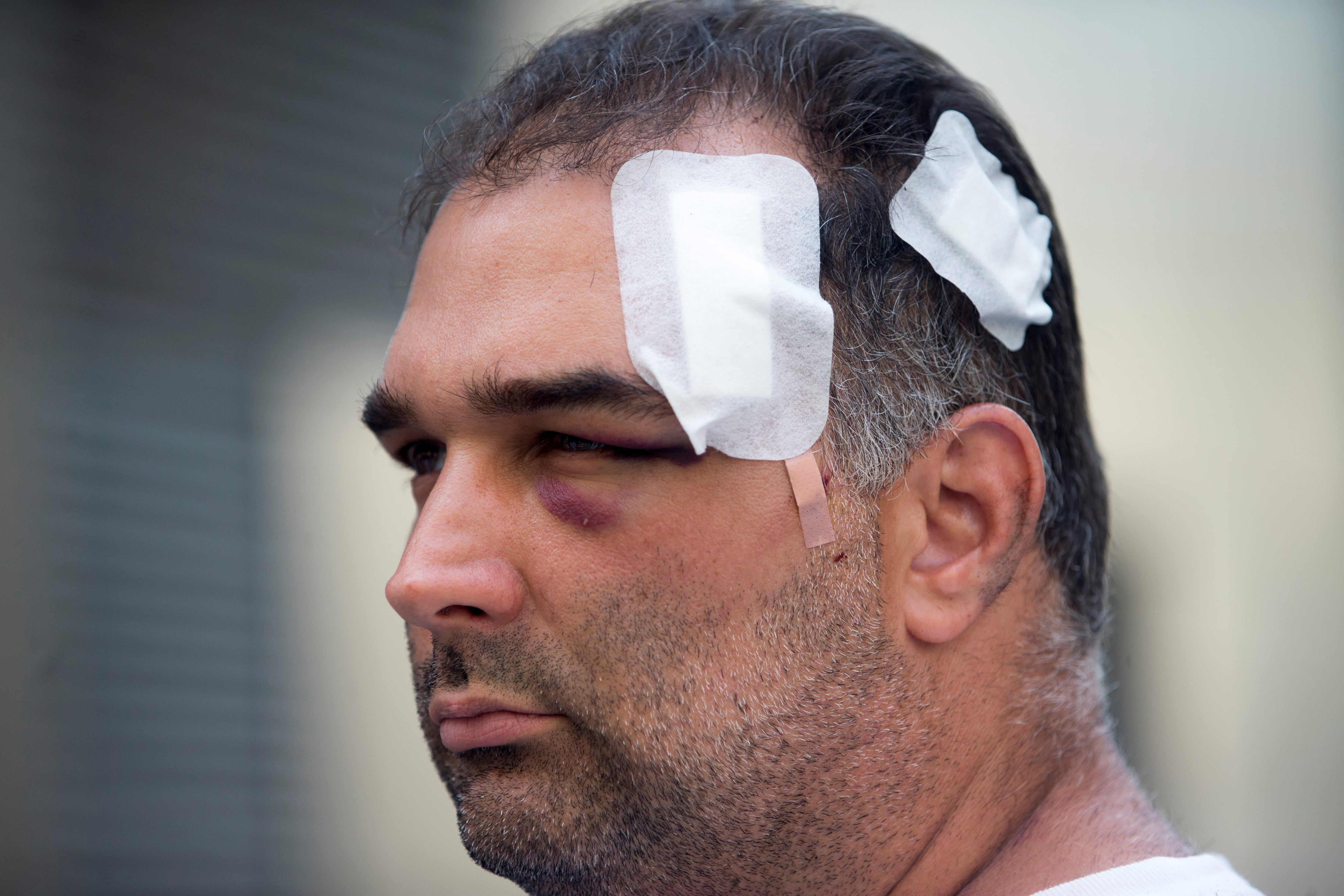 José Bravo, el turistas nortemaericano agredido en la pelea de Barcelona - EFE
