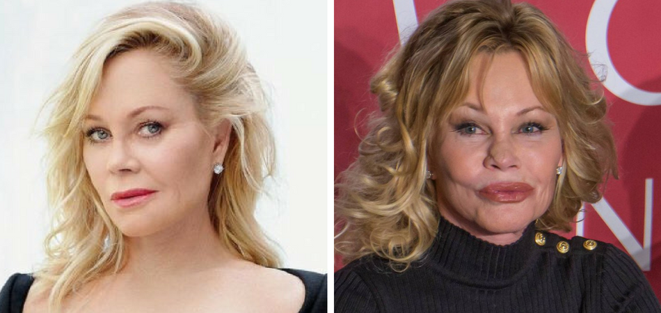 El cambio radical de Melanie Griffith