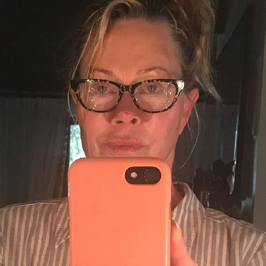 Melanie Griffith con la nariz vendada por su tratamiento - Instagram