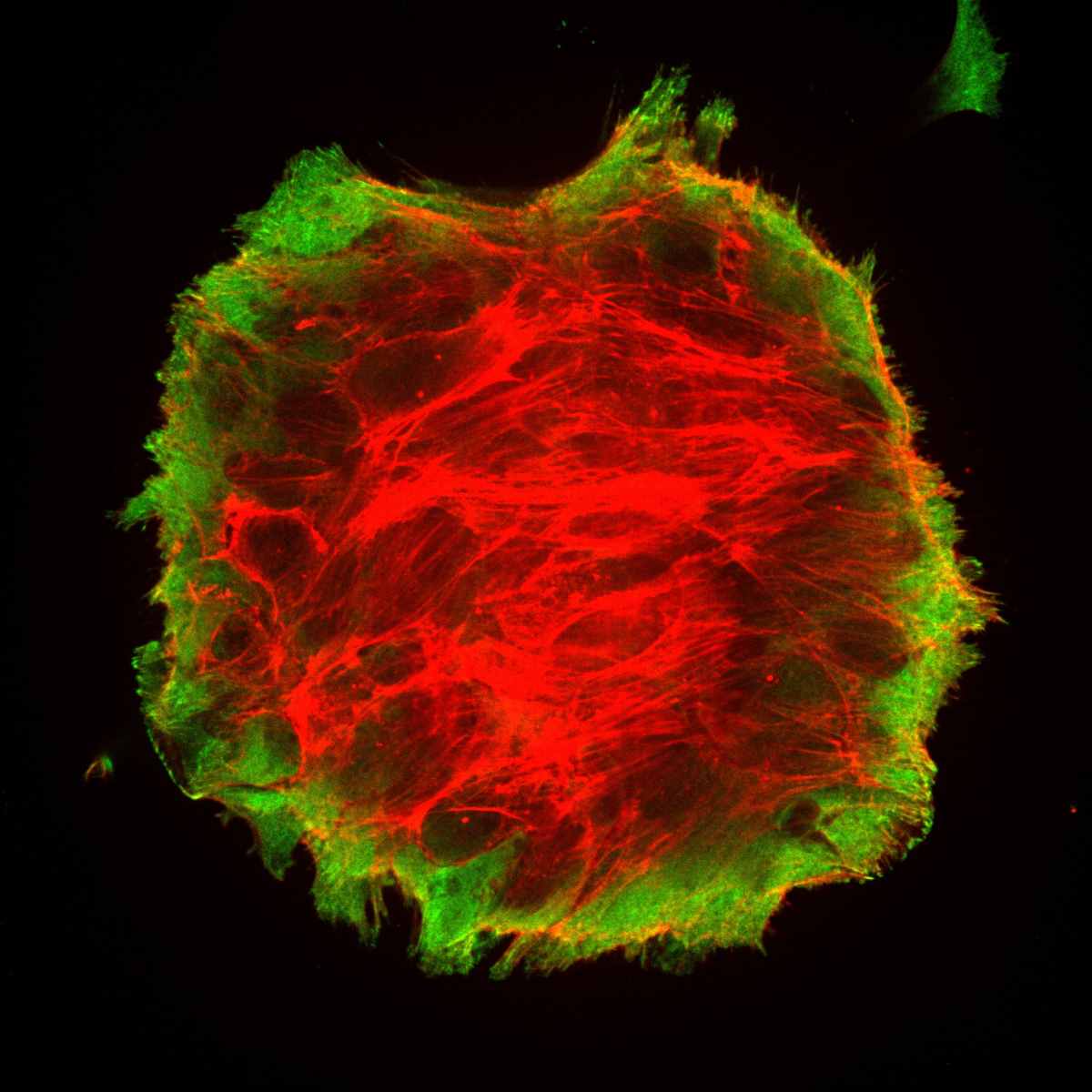 Conjunto de células de cáncer de mama empezando a despegarse de una superficie para formar un agregado esférico. En rojo observamos el citoesqueleto de actina estirando de las adhesiones al sustrato (paxilina), marcadas en verde. 