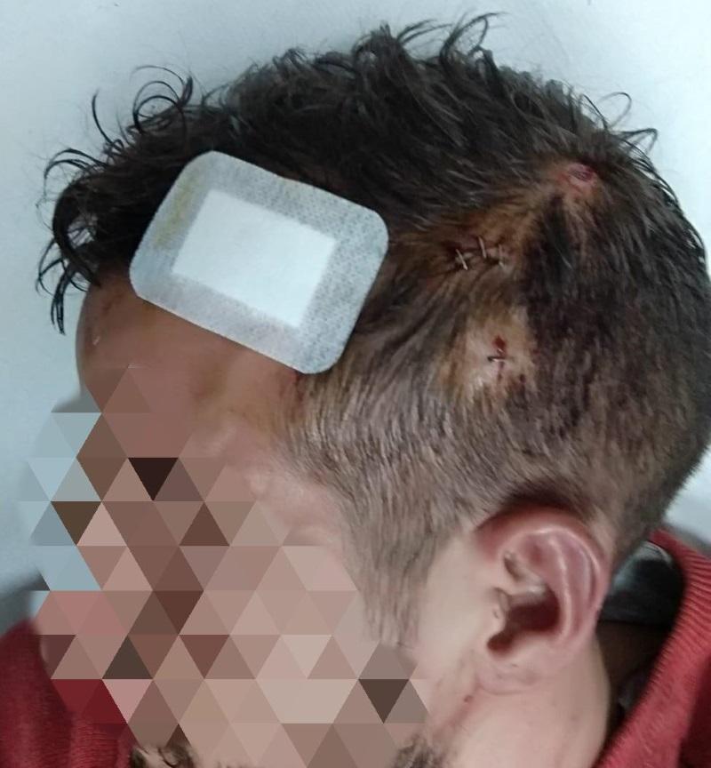 Los golpes sufridos por uno de los agentes. Fuente SUP Los golpes sufridos por uno de los agentes. Fuente SUP