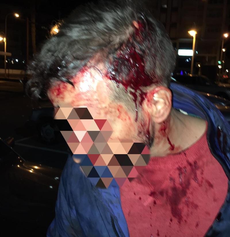 Sangre en la cabeza de un policía. Fuente SUP Sangre en la cabeza de un policía. Fuente SUP