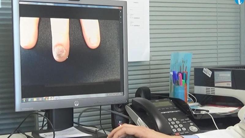Ejemplo de imagen enviada por teleconsulta 2 Ejemplo de imagen enviada por teleconsulta 2