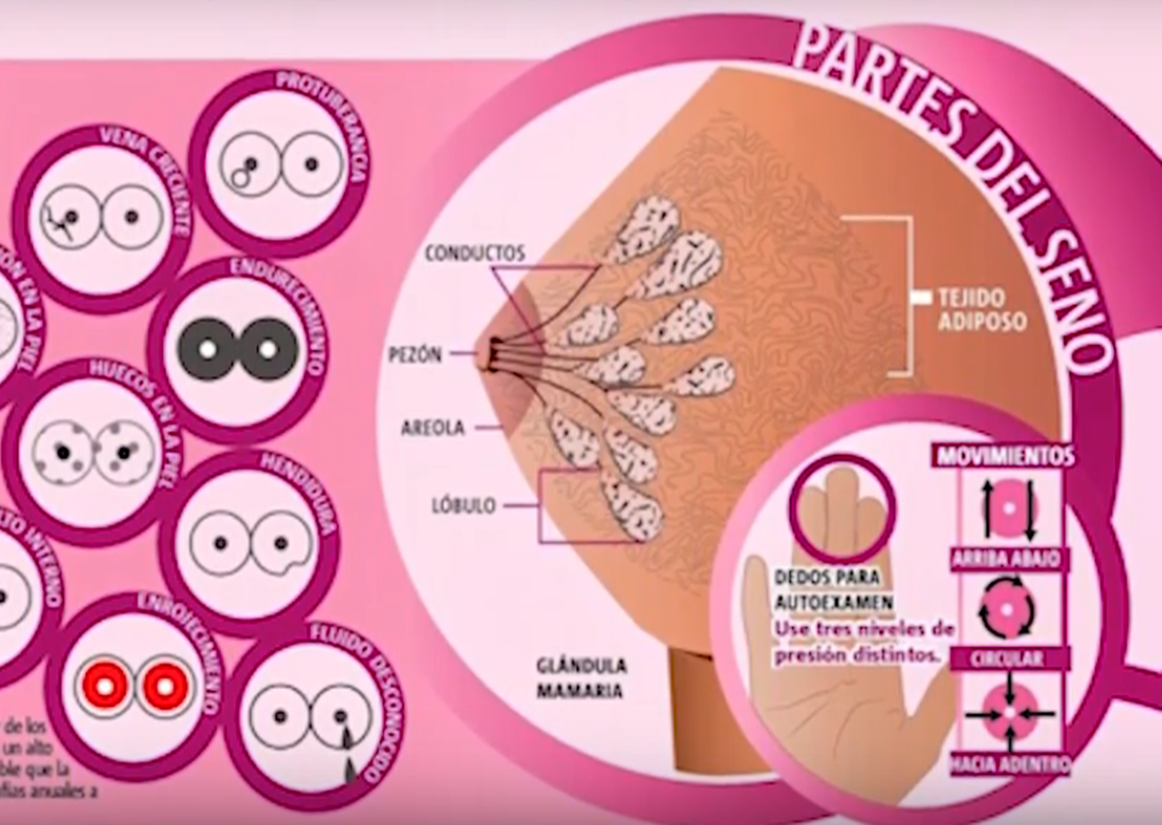 Folleto explicativo de cómo realizar una autoexploración de mama