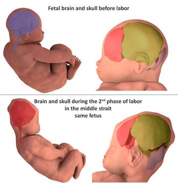 Reconstrucción tridimensional de los huesos craneales antes del parto y durante la segunda parte del mismo. / Agencia SINC