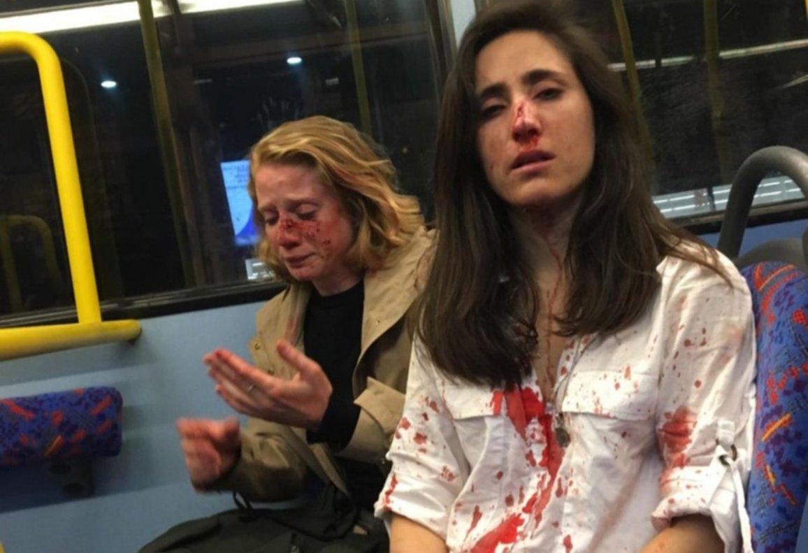 Melania Geymonat y su pareja tras ser agredidas en un autobús nocturno en Londres. Facebook
