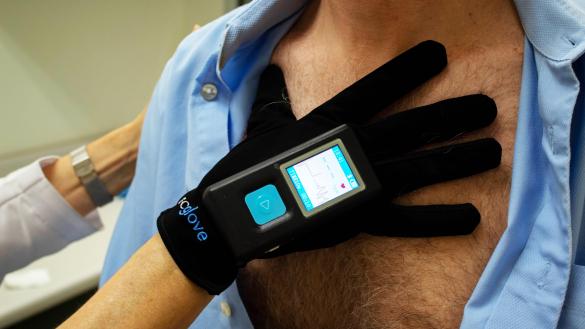 ECGlove es capaz de generar un electrocardiograma en cuestión de segundos ECGlove es capaz de generar un electrocardiograma en cuestión de segundos