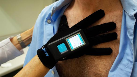 ECGlove es capaz de generar un electrocardiograma en cuestión de segundos