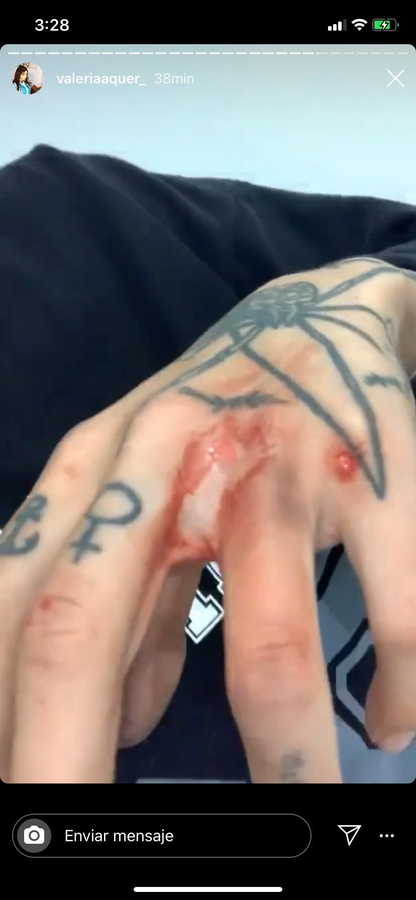 Heridas en la mano de Valeria Quer Heridas en la mano de Valeria Quer
