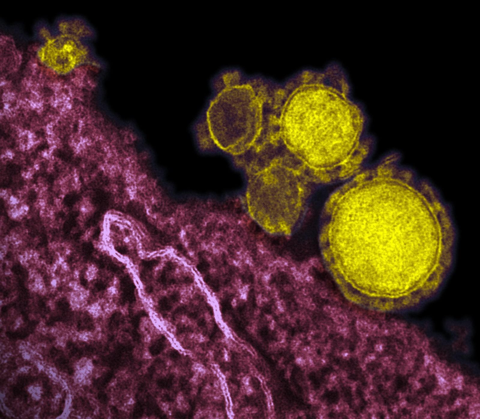 Imagen microscópica del coronavirus