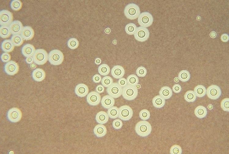 Pictograma del Cryptococcus neoformans. CDC/Dr. Leanor Haley