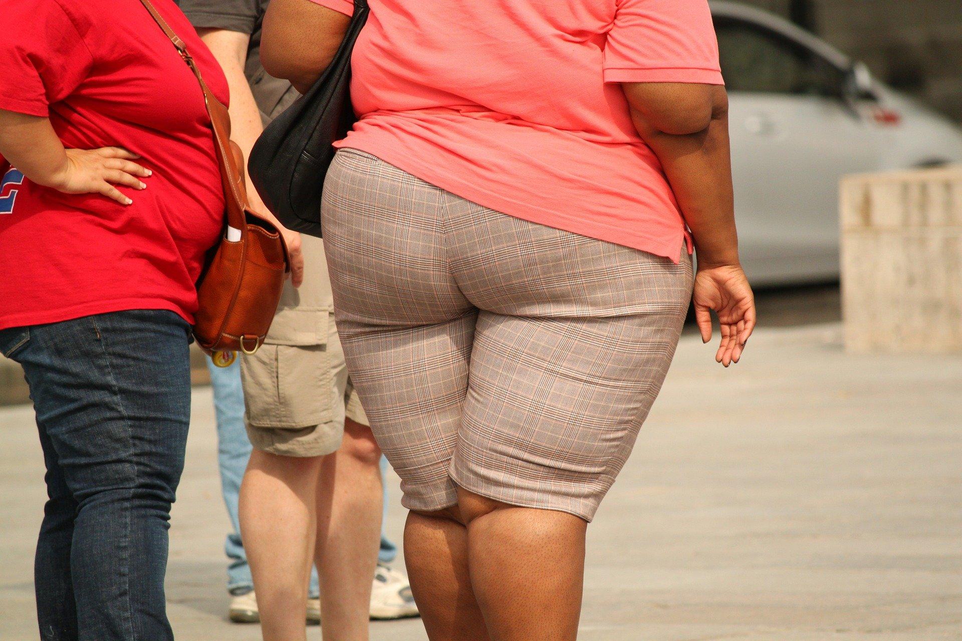 La obesidad se ha convertido en una pandemia mundial que produce 3 millones de muertes cada año