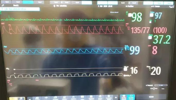 El respirador fabricado en Málaga para ayudar en la crisis del coronavirus  ha sido homologada por la Agencia Española de Medicamentos