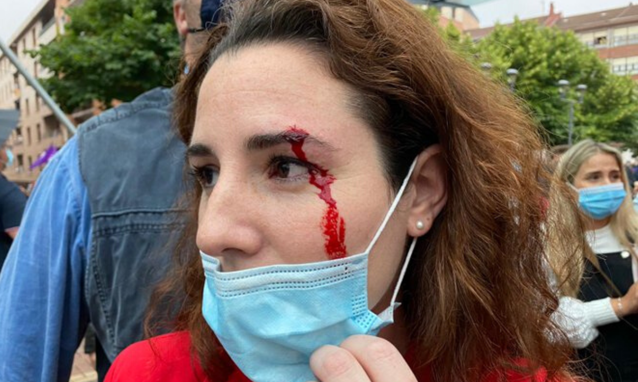 La diputada de Vox Rocío de Meer tras recibir una pedrada en el mitin de Santiago Abascal en Sestao