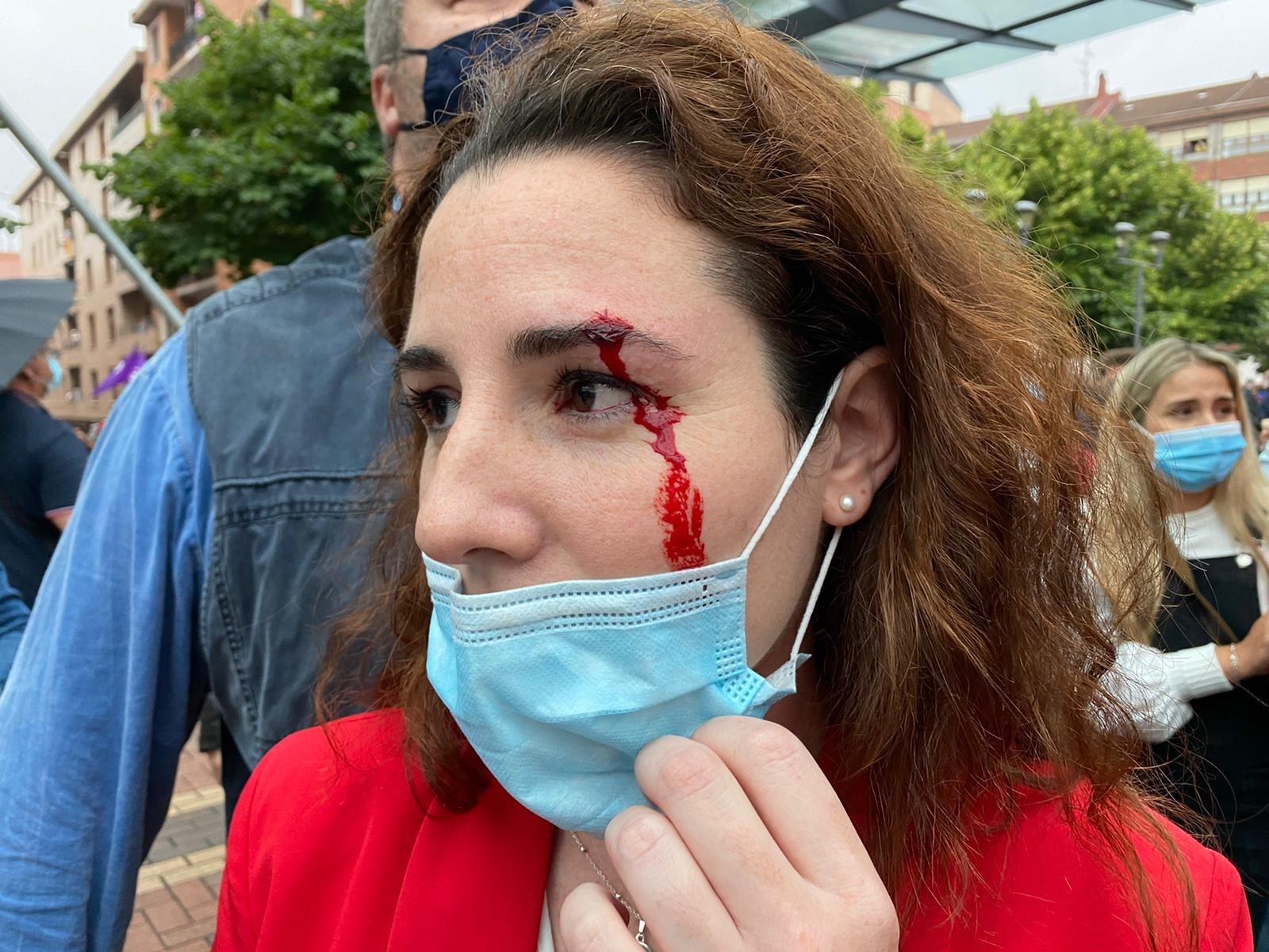 : La diputada de Vox Rocío de Meer sangrando de una ceja tras recibir una pedrada en Sestao (Bizkaia)