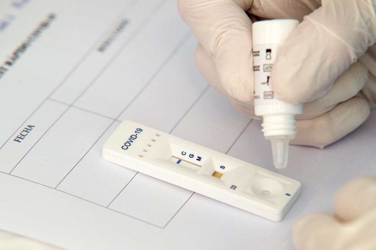 Imagen de una prueba de coronavirus
