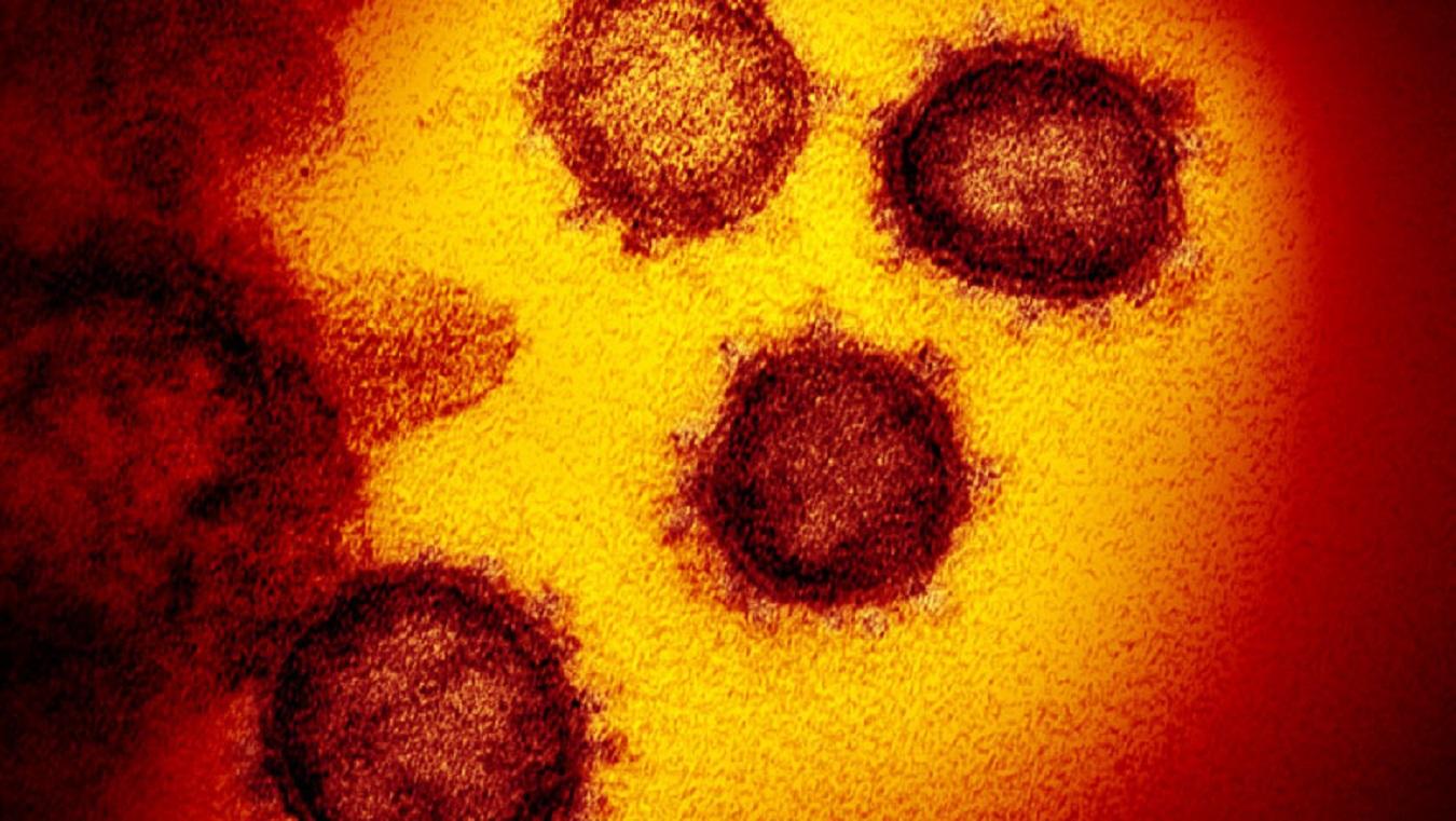 coronavirus   King's College London