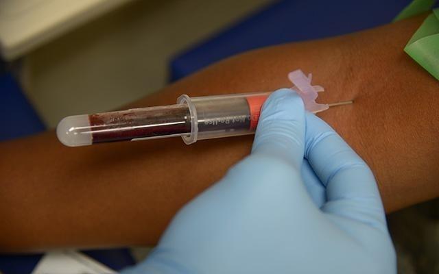 Test de anticuerpos mediante análisis de sangre