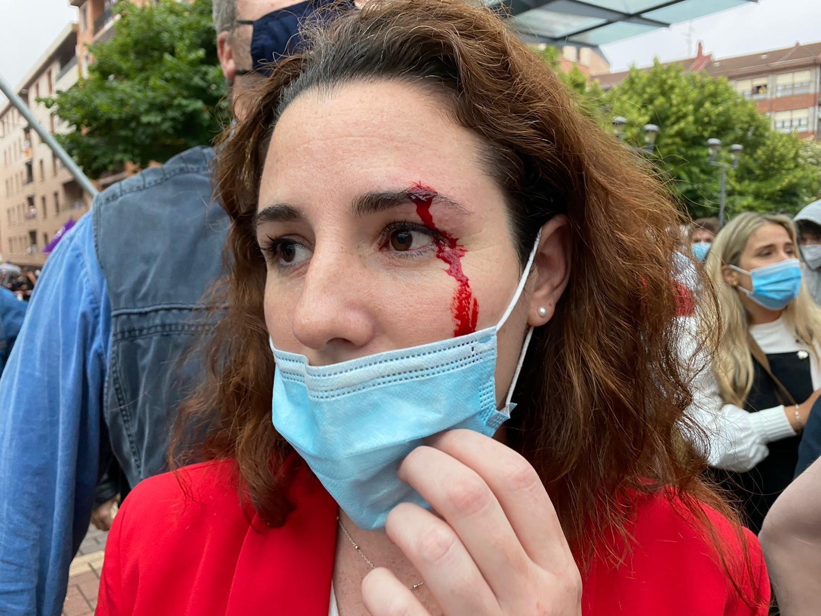 La diputada de Vox Rocío de Meer tras presuntamente recibir una pedrada antes del mitin del partido en Sestao (Vizcaya)