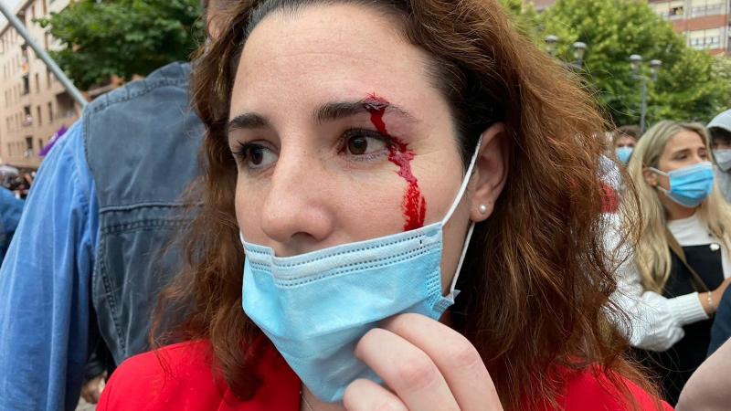 La diputada de Vox Rocío de Meer tras presuntamente recibir una pedrada antes del mitin del partido en Sestao (Vizcaya)