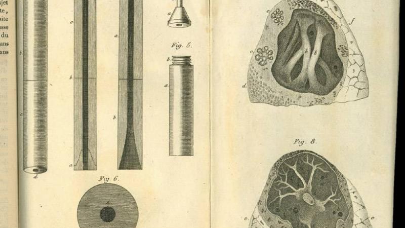 En 1816, el médico francés René Laennec inventó el estetoscopio para diagnosticar a personas con tuberculosis. / Wikimedia Commons