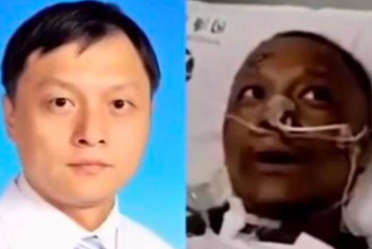 Yi Fan, el médico chino que cambió de color de piel tras contraer el coronavirus. Fuente: Twitter