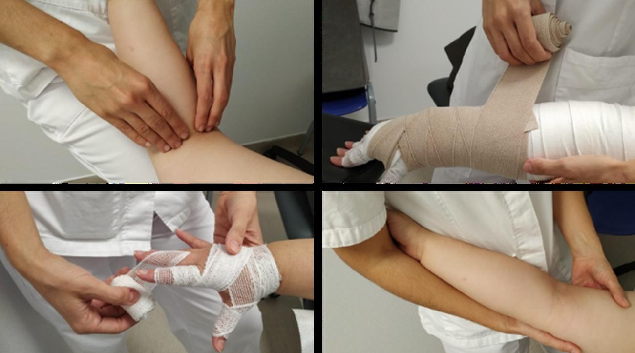 Fisioterapia para tratar el linfedema. 